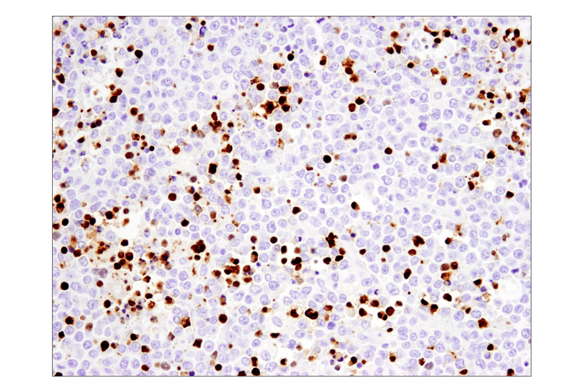 undefined Image 21: Apoptosis Antibody Sampler Kit II