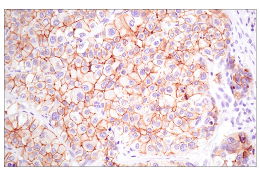 Immunohistochemistry Image 2: E-Cadherin (4A2) Mouse Monoclonal Antibody