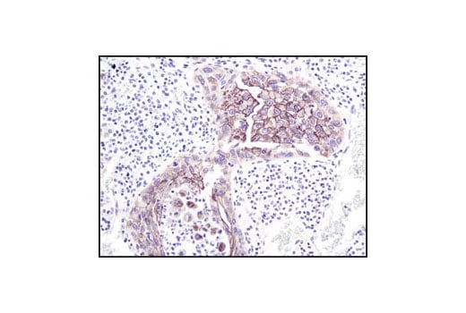 Immunohistochemistry Image 3: gamma-Catenin Antibody