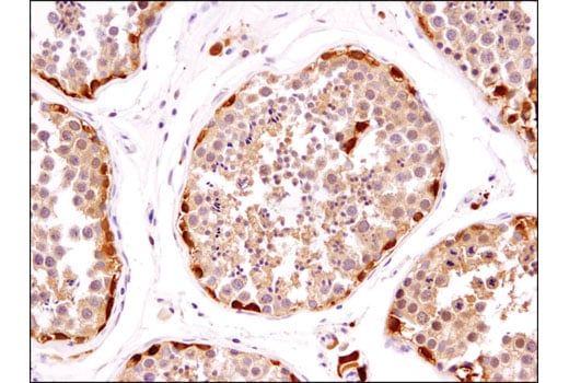 Immunohistochemistry Image 5: TRXR1 (D1T3D) Rabbit Monoclonal Antibody (BSA and Azide Free)