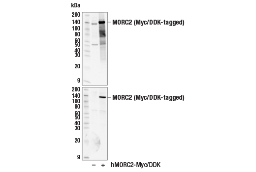 Western Blotting Image 2: MORC2 (E7V4E) Rabbit Monoclonal Antibody