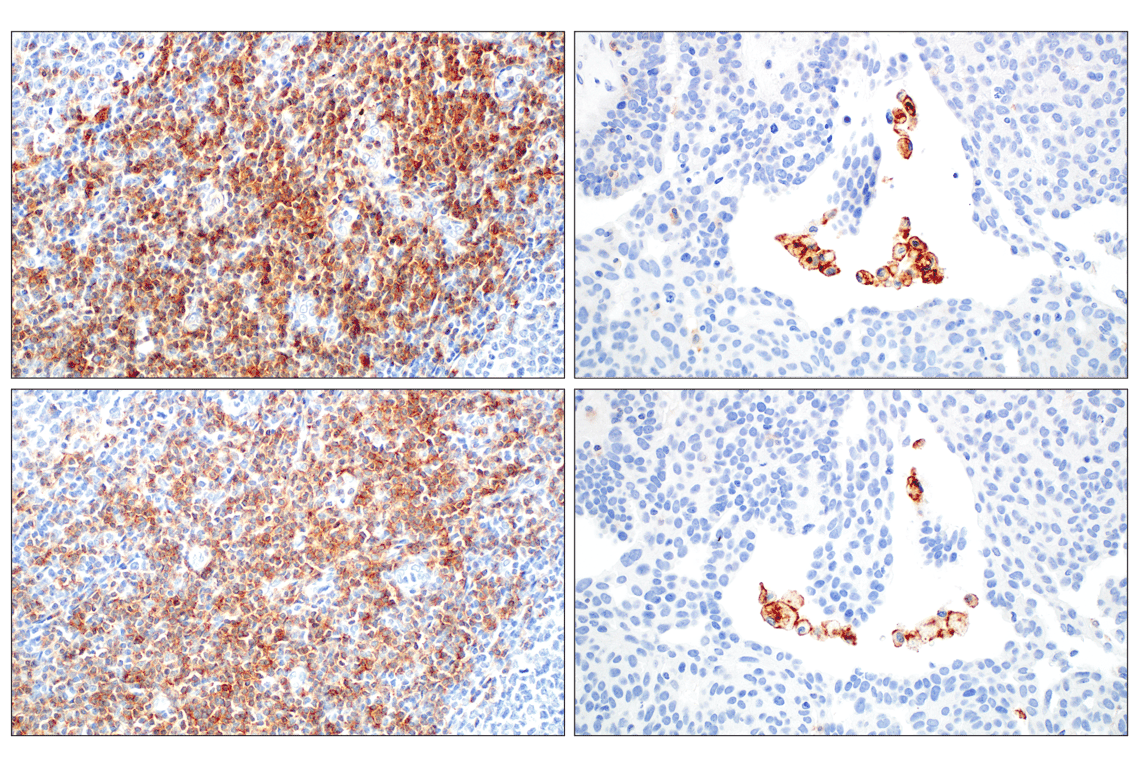 CD28 (D2Z4E) Rabbit mAb | Cell Signaling Technology