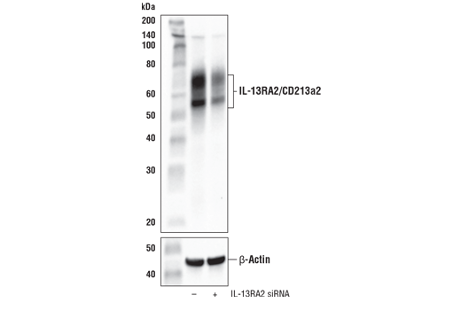 Western Blotting Image 2: IL-13RA2/CD213a2 (E7U7B) Rabbit Monoclonal Antibody