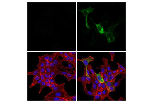 Immunofluorescence Image 1: iNOS (E2M9F) Rabbit Monoclonal Antibody