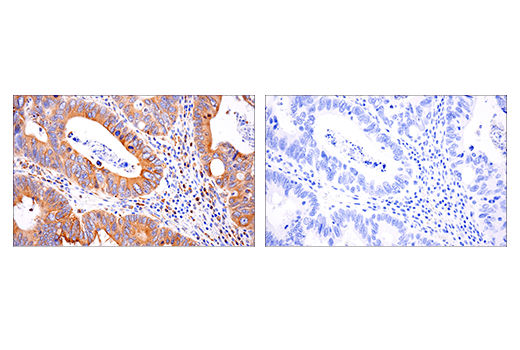 Immunohistochemistry Image 2: PDI (E7O2R) Mouse Monoclonal Antibody
