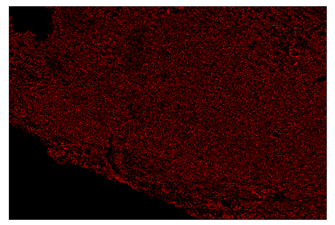 Immunohistochemistry Image 4: CD45 (D3F8Q) & CO-0046-750 SignalStar<sup>™</sup> Oligo-Antibody Pair