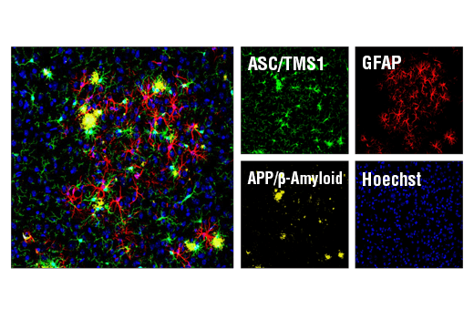 undefined Image 30: Mouse Reactive Inflammasome Antibody Sampler Kit