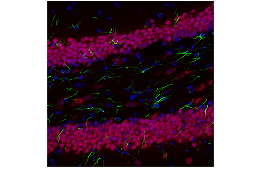 Immunofluorescence Image 1: NeuN (D4G4O) XP<sup>®</sup> Rabbit mAb (Alexa Fluor<sup>®</sup> 647 Conjugate)