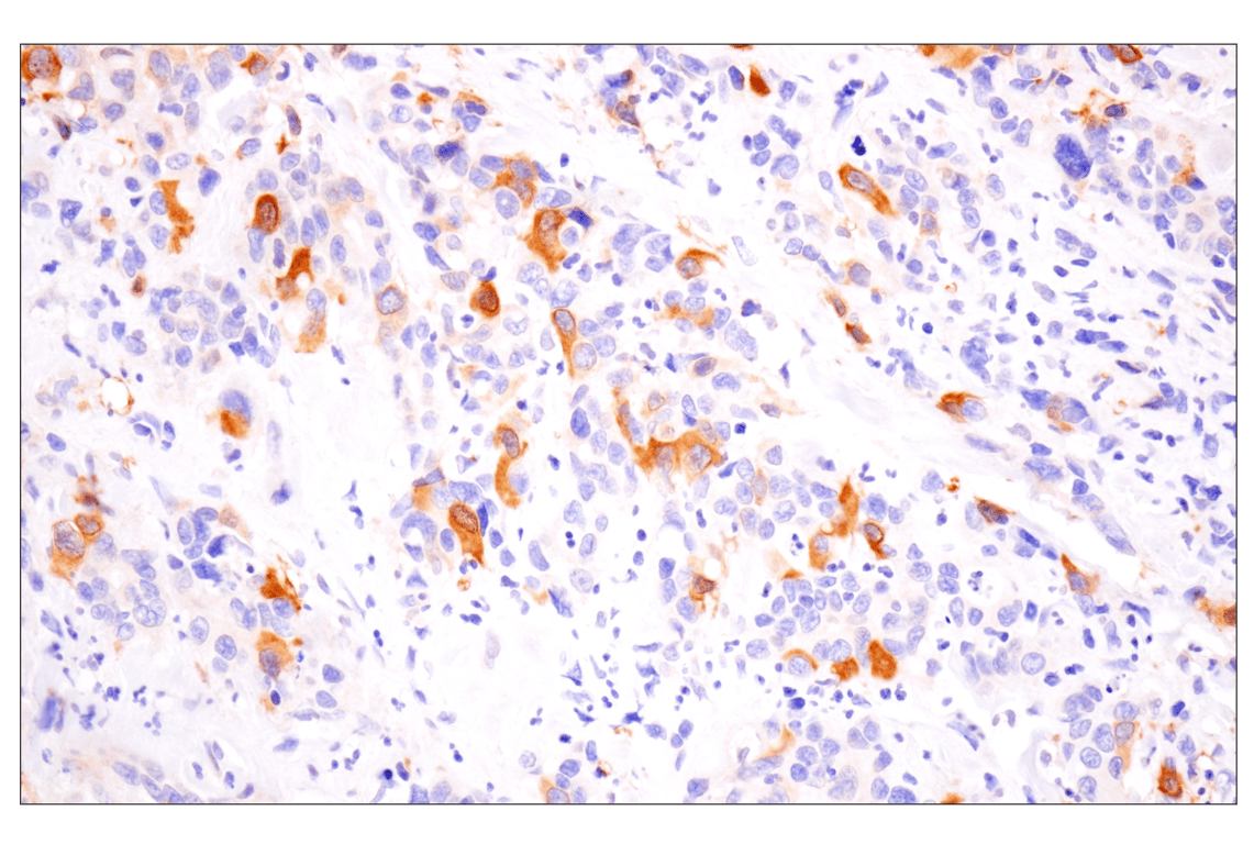 Immunohistochemistry Image 4: Cyclin B1 (F7U1O) Rabbit Monoclonal Antibody