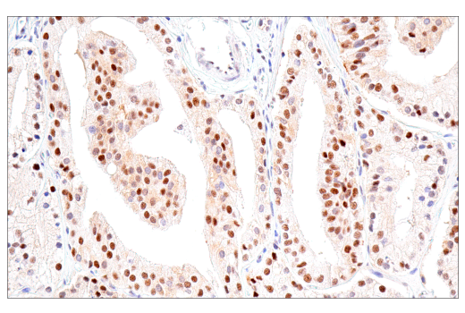 Immunohistochemistry Image 3: NSUN2 (E9Y5E) Rabbit Monoclonal Antibody