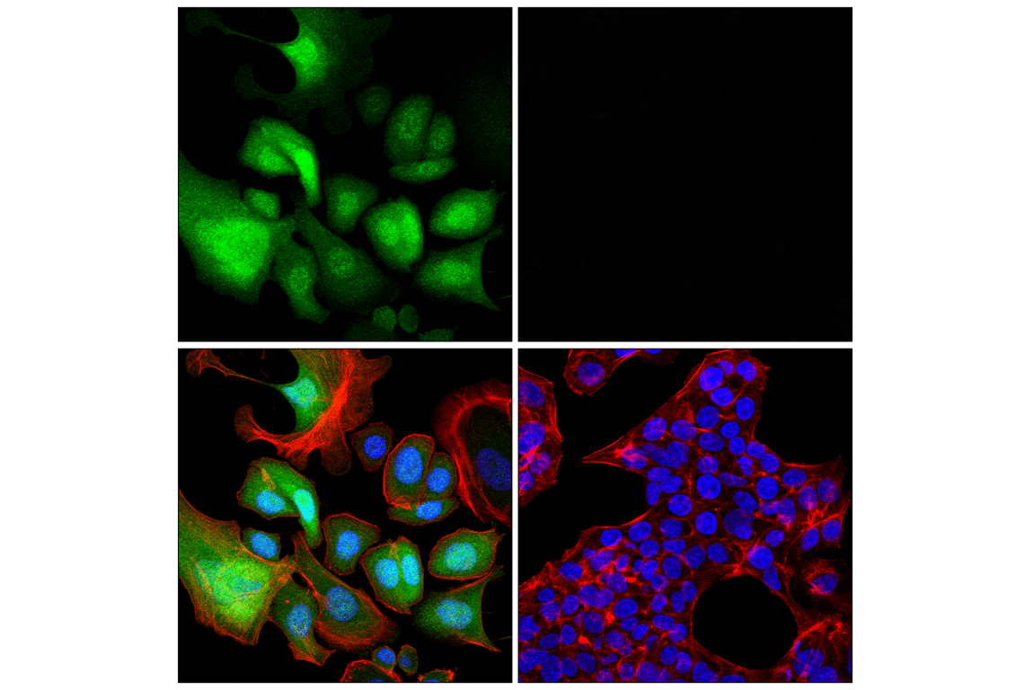 Immunofluorescence Image 1: S100A8 (F4R2W) Rabbit Monoclonal Antibody (BSA and Azide Free)