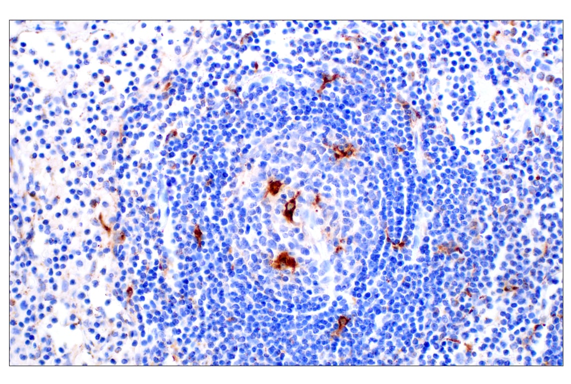 undefined Image 34: Genetics of Parkinson's Disease: Lysosomal Dysfunction Antibody Sampler Kit