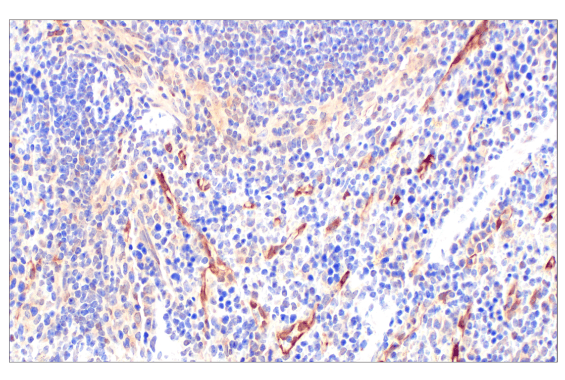 Immunohistochemistry Image 10: Phospho-ATP-Citrate Lyase (Ser455) (F4T8R) Rabbit Monoclonal Antibody