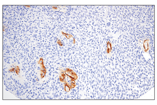 Immunohistochemistry Image 3: IGFBP7 (E3Z8L) Rabbit Monoclonal Antibody