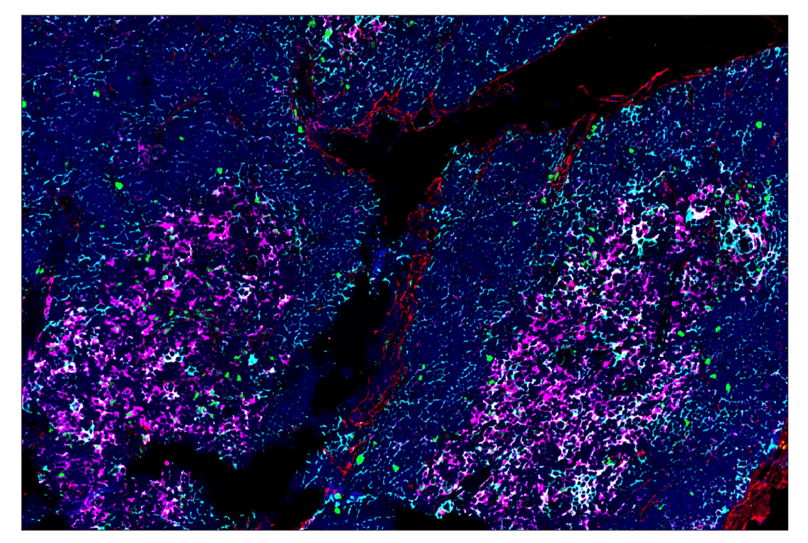 Immunohistochemistry Image 1: IRF-4 (E8H3S) & CO-0233-488 SignalStar<sup>®</sup> Oligo-Antibody Pair