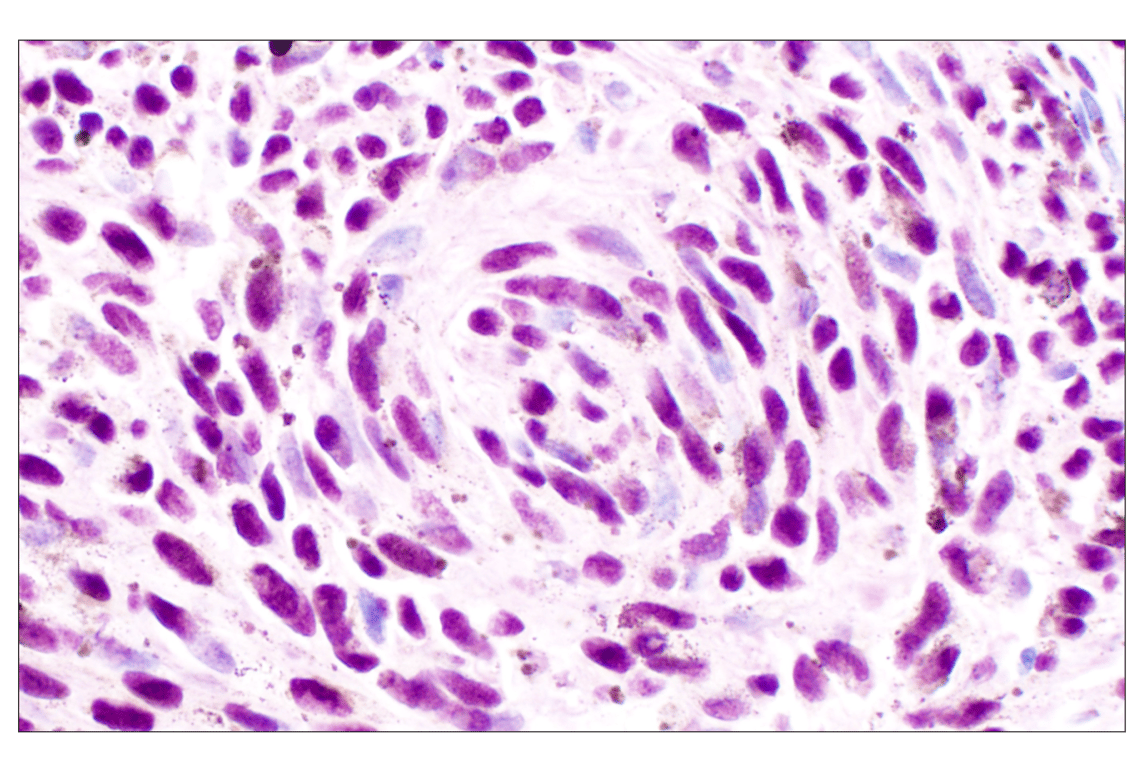 Immunohistochemistry Image 2: Sox10 (E2V9N) Rabbit Monoclonal Antibody