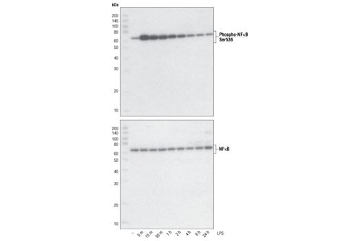 undefined Image 7: NF-κB Pathway Antibody Sampler Kit