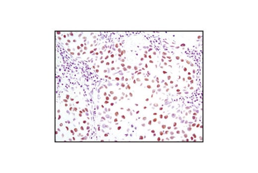 Immunohistochemistry Image 2: JMJD1B (C6D12) Rabbit Monoclonal Antibody