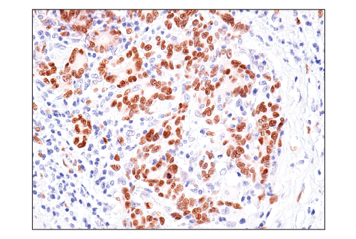 Immunohistochemistry Image 3: TEAD1 (D9X2L) Rabbit Monoclonal Antibody (BSA and Azide Free)