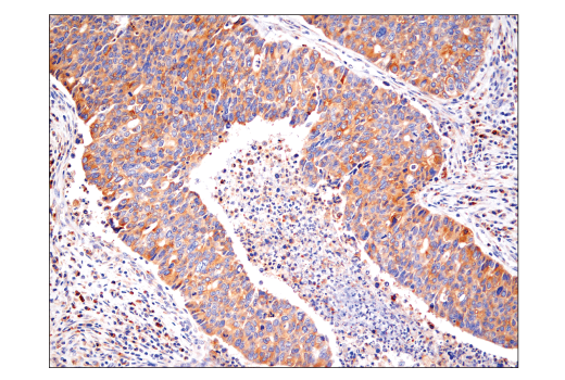 Immunohistochemistry Image 1: NF-kappaB2 p100/p52 (18D10) Rabbit Monoclonal Antibody (BSA and Azide Free)