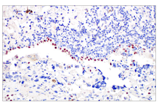 Immunohistochemistry Image 3: POU2F3 (E5N2D) Rabbit Monoclonal Antibody