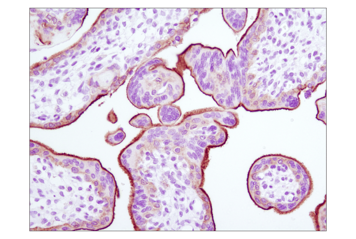 Immunohistochemistry Image 3: EGF Receptor (D38B1) Rabbit Monoclonal Antibody