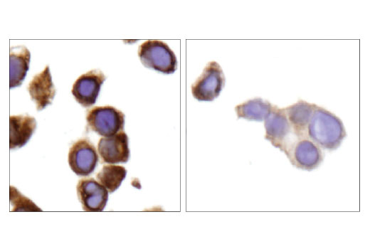 Immunohistochemistry Image 3: Lyric/Metadherin (D5Y8R) Rabbit Monoclonal Antibody
