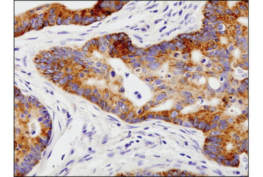 Immunohistochemistry Image 2: FGF Receptor 2 (D4L2V) Rabbit Monoclonal Antibody (BSA and Azide Free)