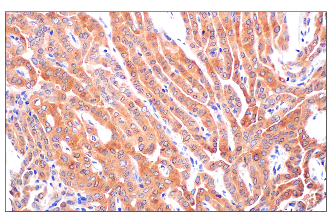 Immunohistochemistry Image 2: PIP4K2C (E7P3S) Rabbit Monoclonal Antibody (BSA and Azide Free)