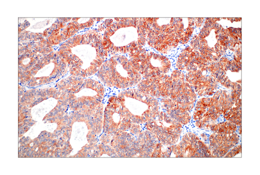 Immunohistochemistry Image 7: Pan-Keratin (C11) Mouse Monoclonal Antibody