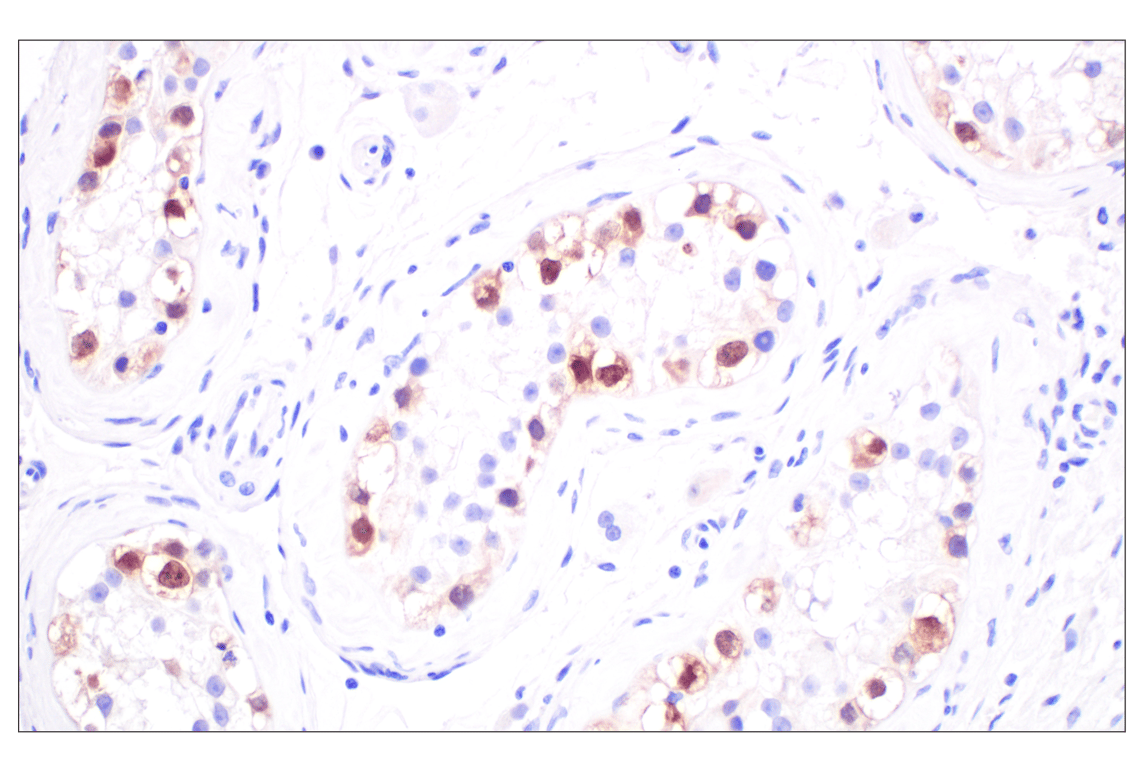 Immunohistochemistry Image 5: TCL1 (F9R1X) Rabbit Monoclonal Antibody