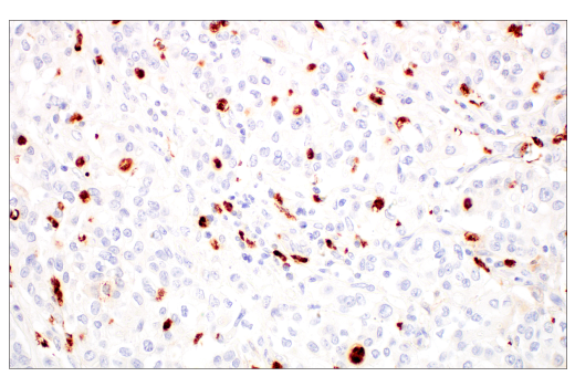 Immunohistochemistry Image 2: MMP-8 (E1C4L) Rabbit Monoclonal Antibody