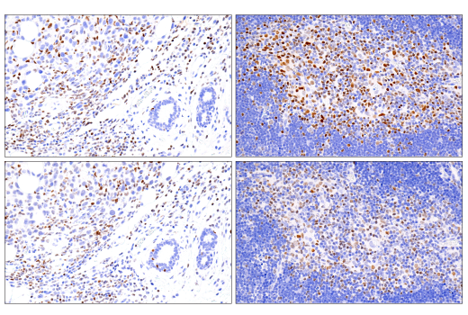 Immunohistochemistry Image 5: RUNX3/AML2 (D6E2) Rabbit Monoclonal Antibody