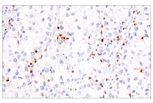 Immunohistochemistry Image 3: CCL5/RANTES (E9S2K) Rabbit Monoclonal Antibody