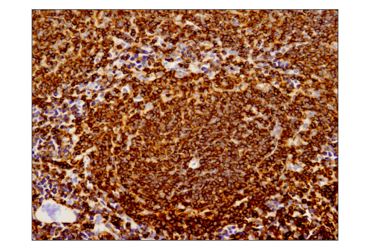 Immunohistochemistry Image 1: CD45 (D3F8Q) Rabbit Monoclonal Antibody (BSA and Azide Free)