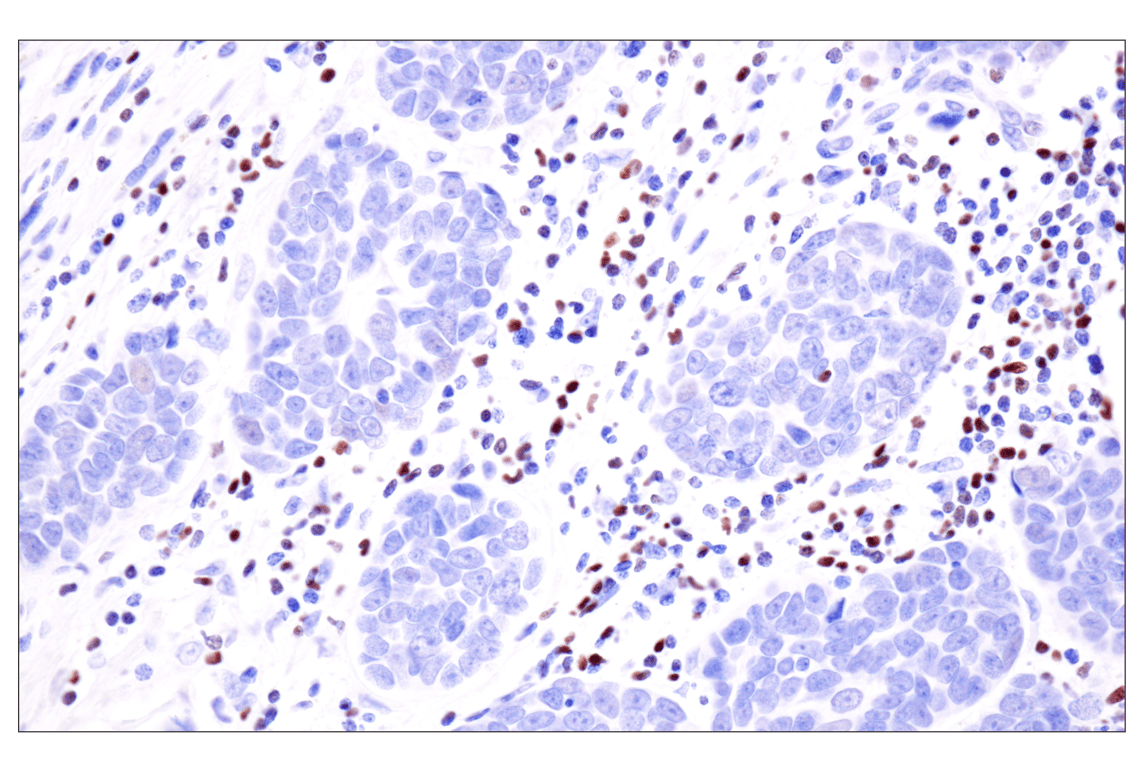 Immunohistochemistry Image 2: TCF1/TCF7 (E6O1K) Rabbit Monoclonal Antibody