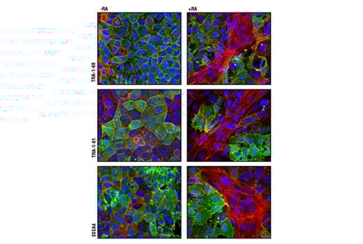 undefined Image 4: StemLight<sup>™</sup> Pluripotency IF Antibody Sampler Kit