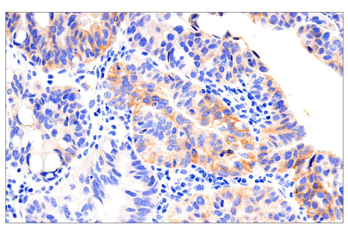 Immunohistochemistry Image 4: EphA2 (D4A2) Rabbit Monoclonal Antibody (BSA and Azide Free)