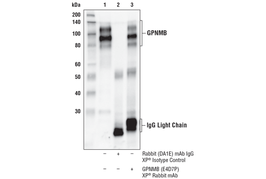 Immunoprecipitation Image 1: GPNMB (E4D7P) Rabbit Monoclonal Antibody