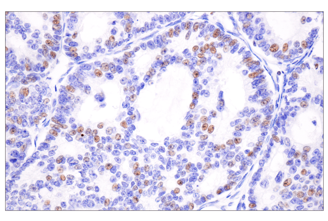 Immunohistochemistry Image 3: Acetyl-Histone H4 (Lys16) (E2B8W) Rabbit Monoclonal Antibody