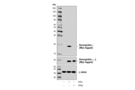 Western Blotting Image 2: Hemoglobin gamma (D4K7X) Rabbit Monoclonal Antibody