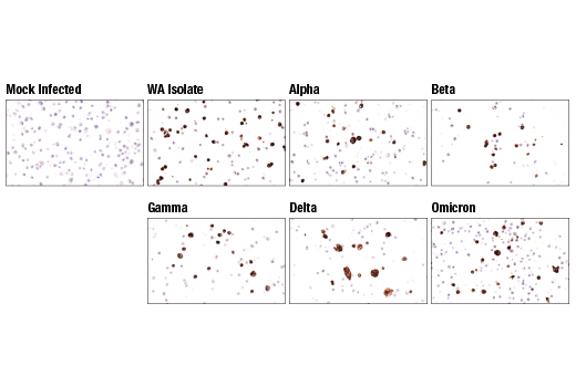 Immunohistochemistry Image 6: SARS-CoV-1/2 Spike Protein (2B3E5) Mouse Monoclonal Antibody