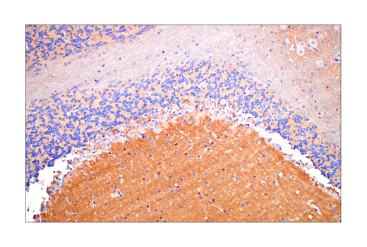 Immunohistochemistry Image 8: Src (36D10) Rabbit Monoclonal Antibody (BSA and Azide Free)