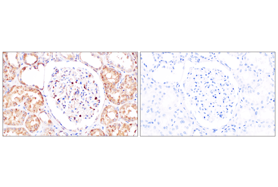 Immunohistochemistry Image 9: Catalase (D4P7B) Rabbit Monoclonal Antibody