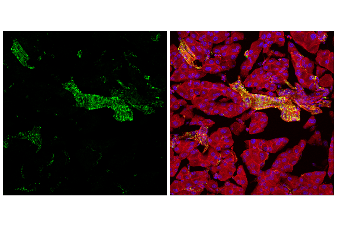 Immunofluorescence Image 2: Hexokinase I (C35C4) Rabbit Monoclonal Antibody (BSA and Azide Free)