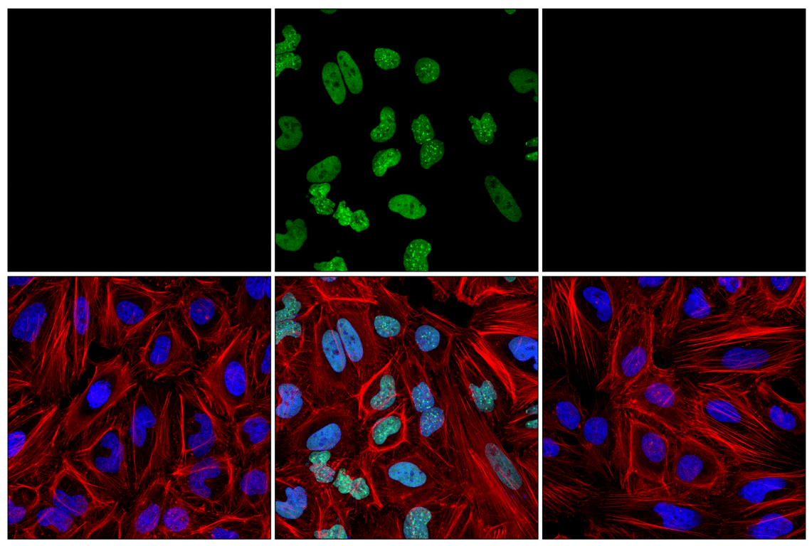 Immunofluorescence Image 1: Phospho-KAP-1 (Ser824) (F7D9Q) Rabbit Monoclonal Antibody