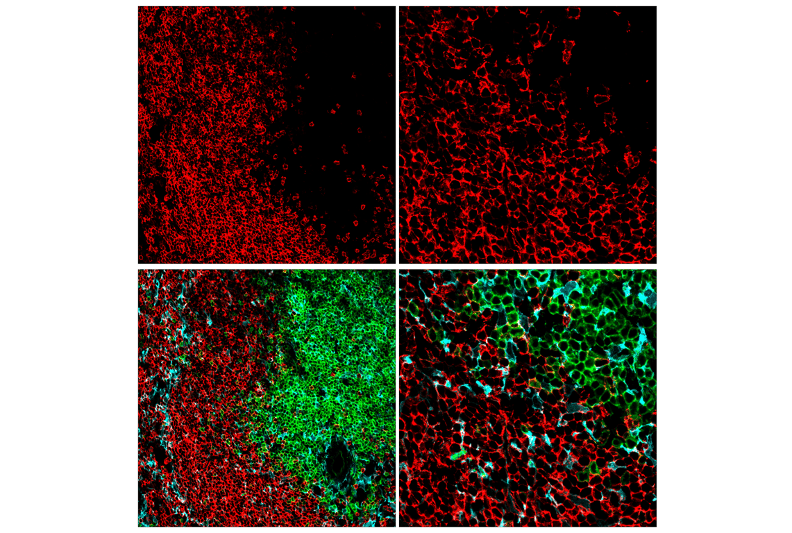 Immunofluorescence Image 1: CD20 (E3N7O) Rabbit Monoclonal Antibody (BSA and Azide Free)