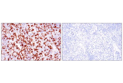Immunohistochemistry Image 7: TIGIT (E5Y1W) Rabbit Monoclonal Antibody