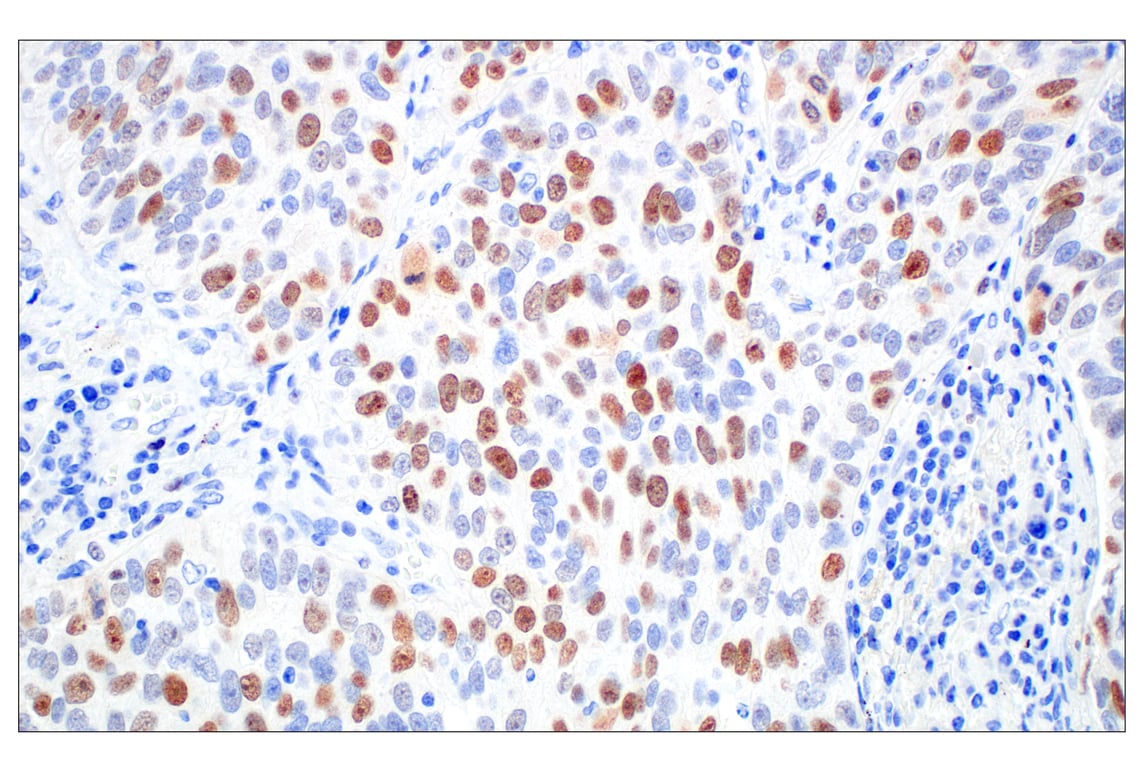 Immunohistochemistry Image 4: BRCA1 (E5S9G) Rabbit Monoclonal Antibody