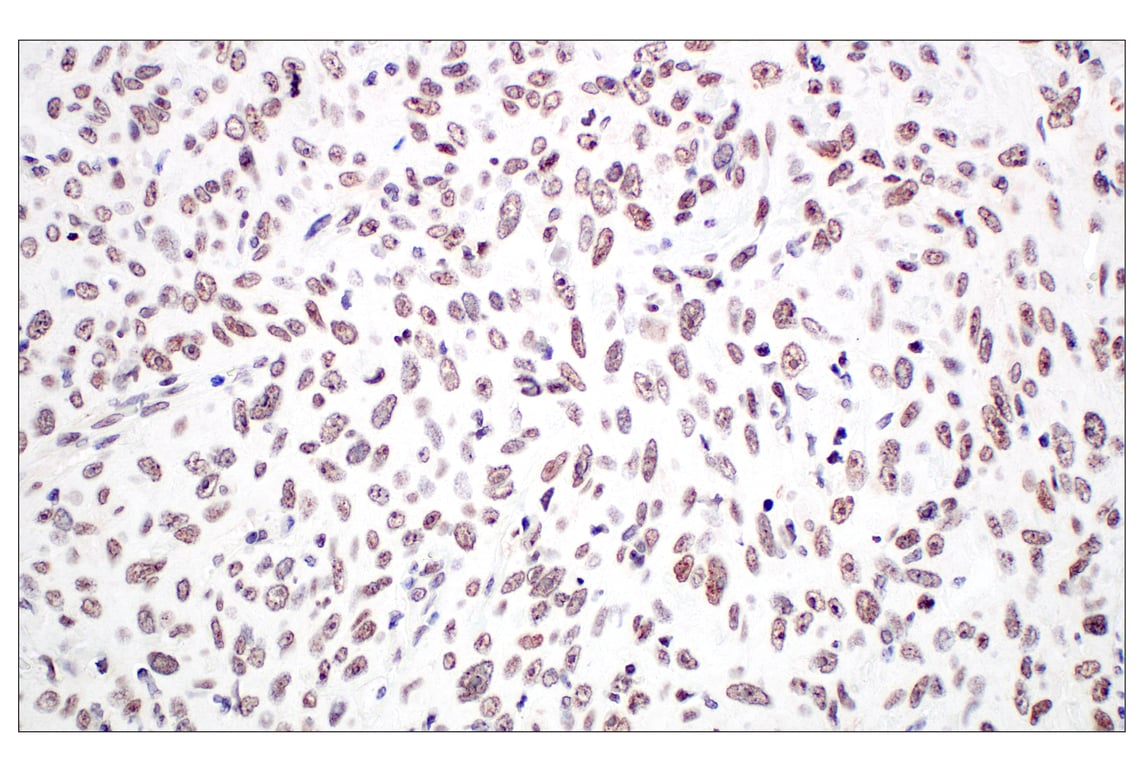 Immunohistochemistry Image 3: Menin (E5P1R) Rabbit Monoclonal Antibody